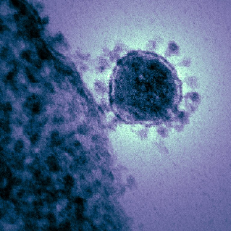 Virus SRAS-CoV-2